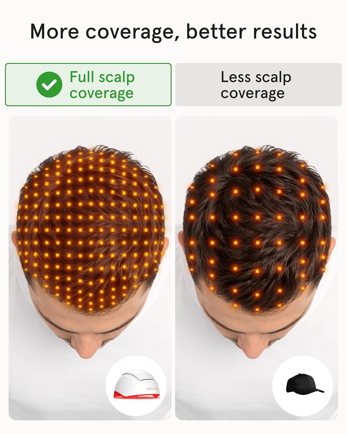 iRestore Professional Laser Red Light Therapy for Hair Growth System – FDA Cleared Hair Loss, Hair Thinning & Alopecia Treatment for Men & Women – 282 Lasers & LEDs - Image 3